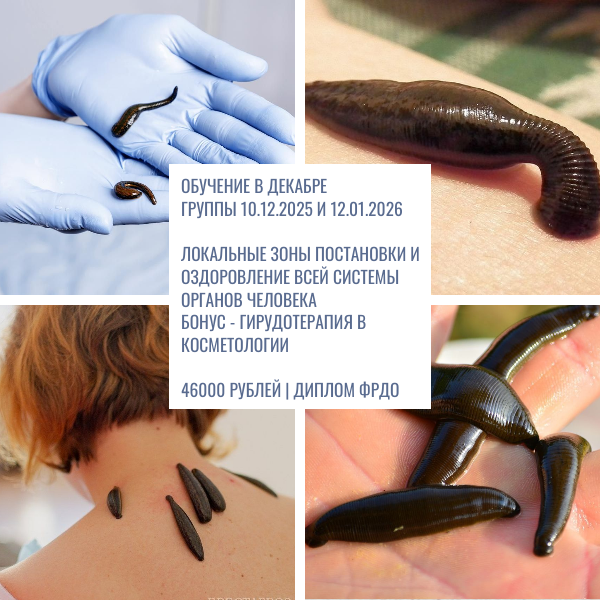 курсы гирудотерапии